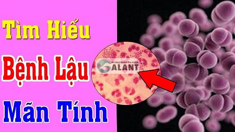 Các phương án điều trị bệnh lậu hiệu quả cao